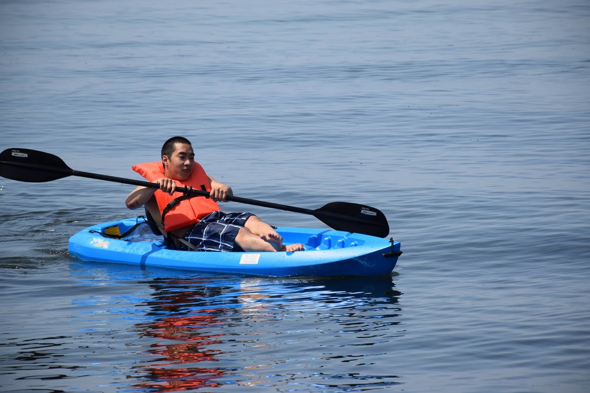 asbestosis is a shape of