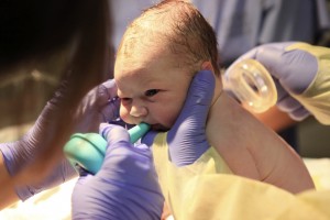 Birth Injury