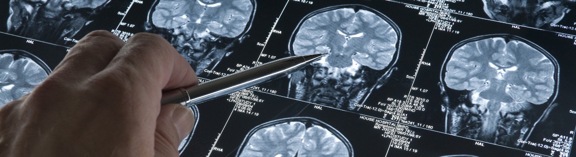 types of cerebral palsy